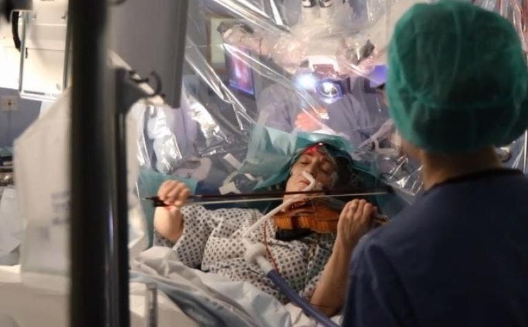 [VIDEO] Para salvar sus manos, una violonista toca durante su operación de cerebro