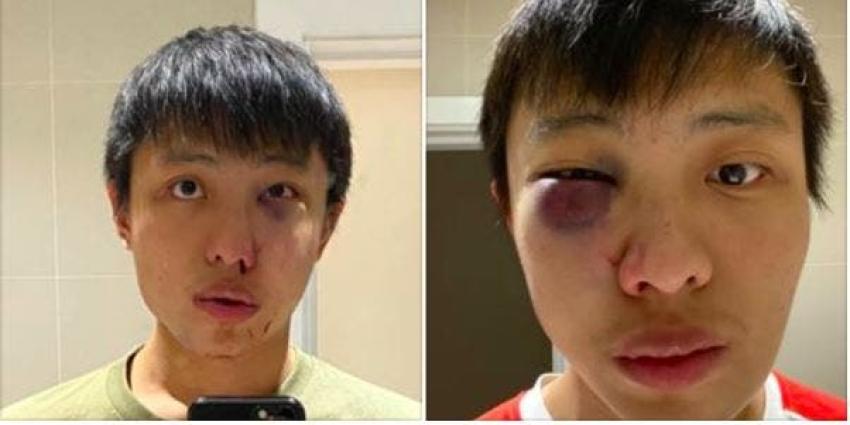 Estudiante de Singapur sufre violento ataque en Londres tras burlas racistas por coronavirus