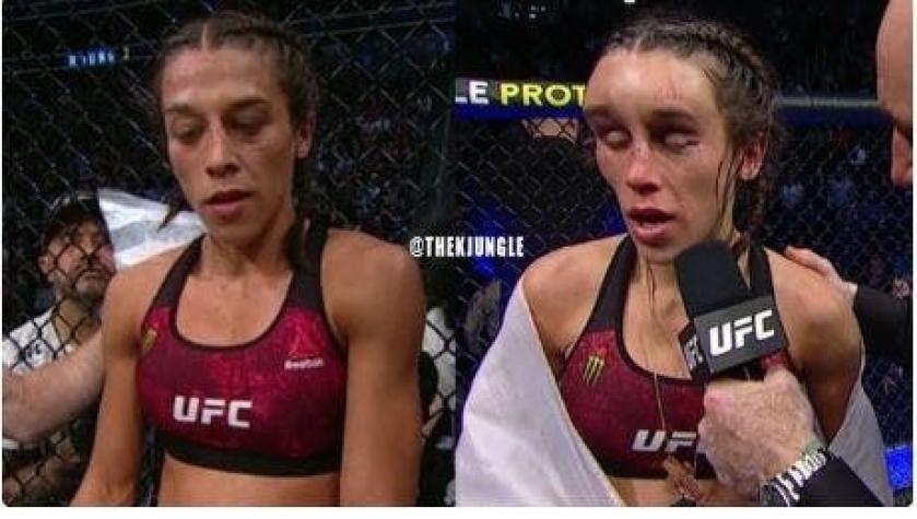 [FOTOS] El impactante antes y después del rostro de una boxeadora tras combate de UFC