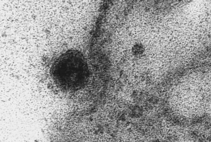 [VIDEO] Logran captar el momento en que el coronavirus infecta a una célula