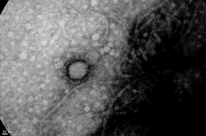 Científicos logran captar primera foto del coronavirus en Argentina