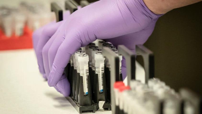 Test de coronavirus: los científicos que crearon una prueba de diagnóstico "casera"