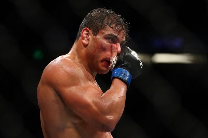 Luchador de la UFC donará su cerebro para el estudio de los efectos de los golpes en la cabeza