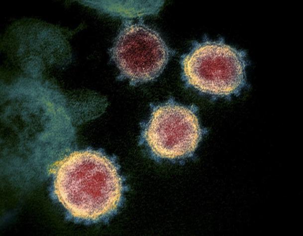 El antiviral remdesivir es eficaz contra el coronavirus, según un estudio