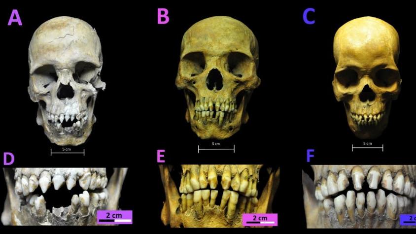Los secretos que revelan los esqueletos de 3 esclavos africanos del siglo XVI descubiertos en México
