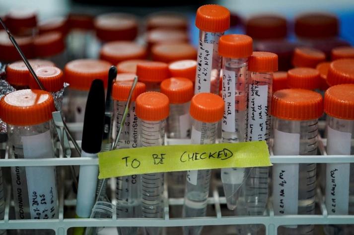 Estados Unidos aprueba test de coronavirus con saliva recolectada en el hogar