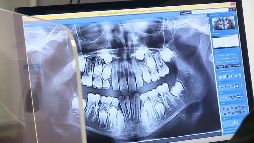 [VIDEO] Reportajes T13: "Pandemia, el dolor de los dentistas"