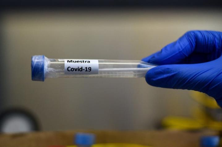 Muertos en Chile por coronavirus llegan a los 312 y número de contagiados supera los 28 mil