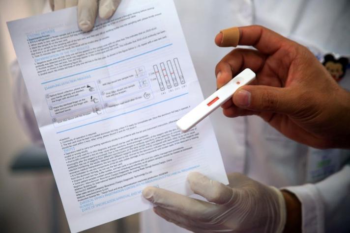 Minsal ante suspensión de examen PCR en clínicas: "No existe quiebre de stock a nivel nacional"