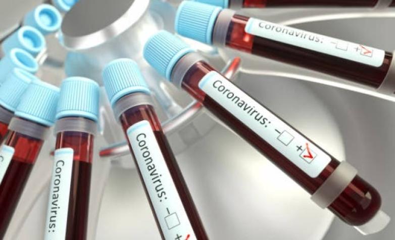 Campaña busca que pacientes recuperados de COVID-19 donen plasma para combatir enfermedad