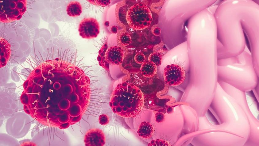 Cáncer: qué son las nanocápsulas, la nueva frontera de la lucha contra la enfermedad