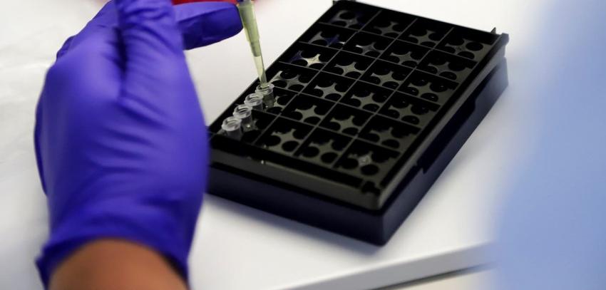 PCR por saliva: Cómo funcionará el nuevo examen tomado por el propio paciente