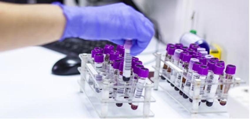 Laboratorio chileno desarrolla técnica que reduce el tiempo de procesamiento de test PCR