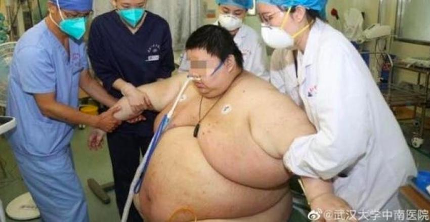 Hombre subió 100 kilos en el confinamiento por el coronavirus