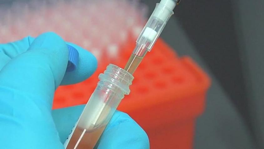 [VIDEO] Investigación asegura que grupo sanguíneo podría definir riesgo ante el coronavirus