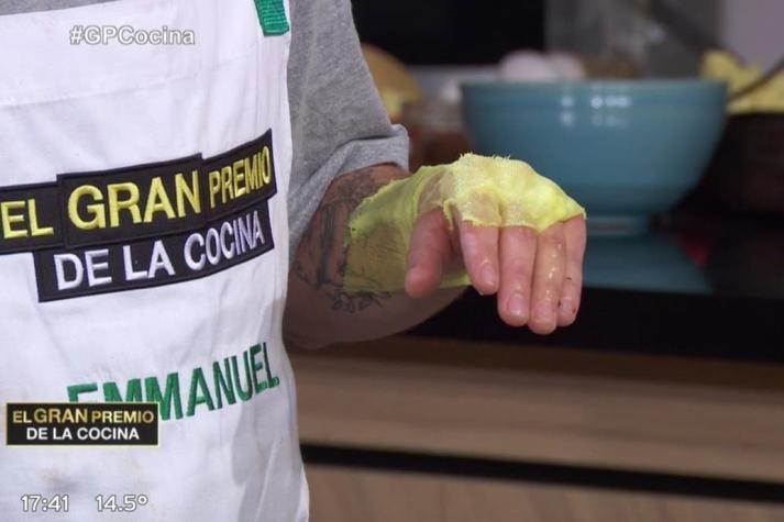 Gran susto en vivo: participante de programa de cocina argentino sufrió terrible quemadura