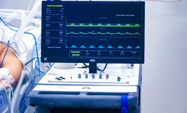 Ventilador mecánico Asmar-UdeC se alista para su fabricación tras pasar prueba clínica