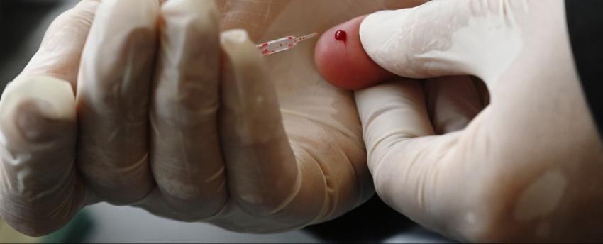 Análisis de sangre podría detectar el cáncer años antes de la aparición de los síntomas
