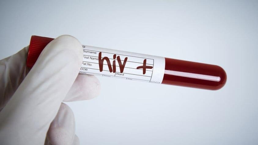 Estudio asegura que mujer se habría curado del VIH sin ningún tratamiento médico