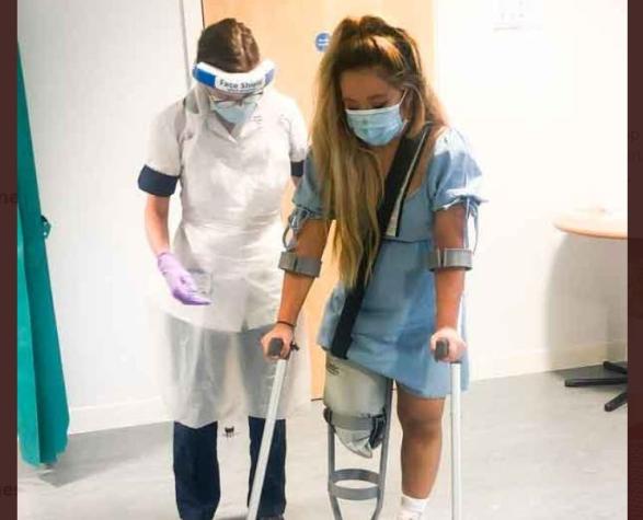 Enfermera pierde una pierna por ignorar dolores mientras trabajaba conteniendo el coronavirus