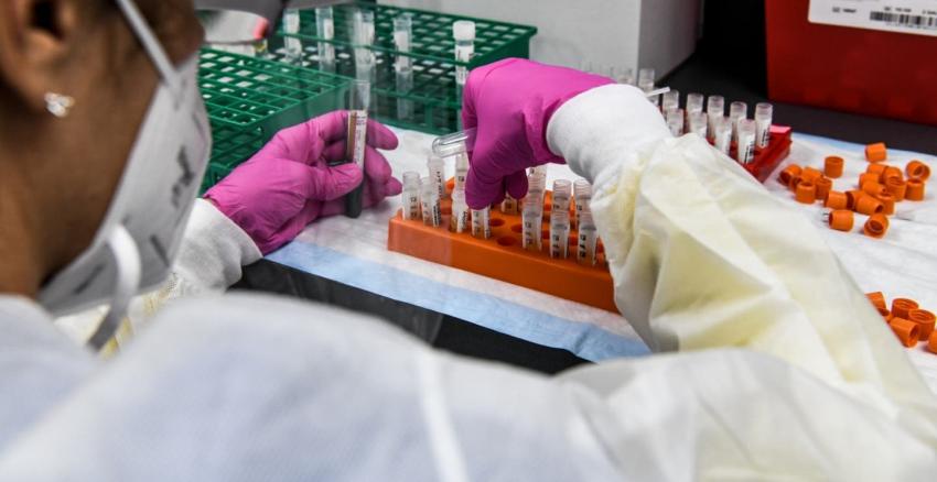 Australia producirá vacuna contra el coronavirus que suministrará gratis a la población