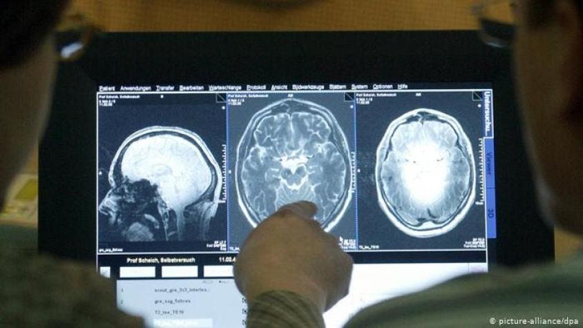 Estudio revela 10 grandes factores para prevenir Alzheimer