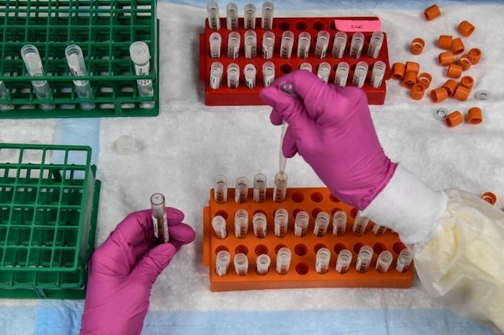 EE.UU pide a sus estados prepararse para distribuir vacuna contra el COVID-19 en noviembre