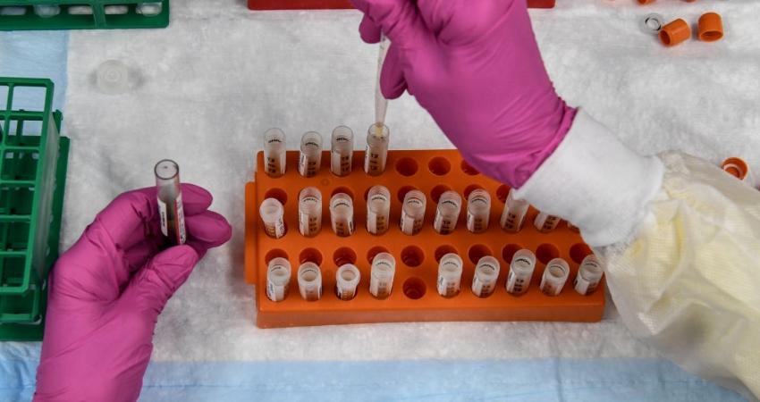 Pruebas de vacuna contra el COVID-19 en Chile comenzarán en dos semanas