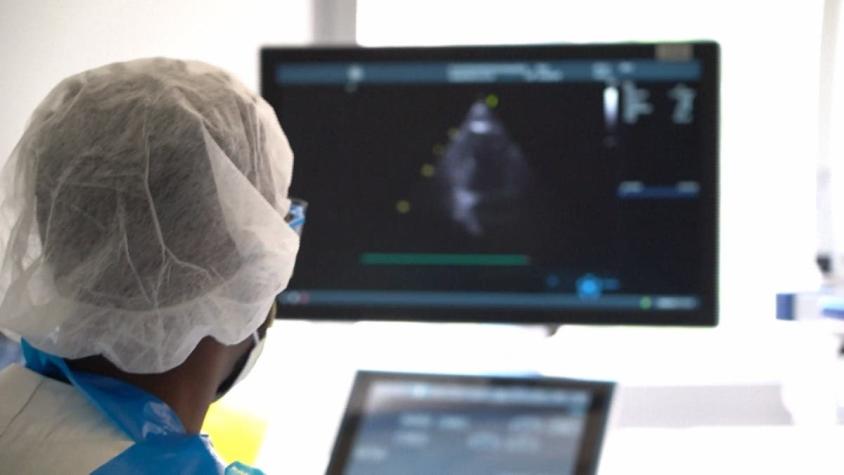 [VIDEO] Estudio revela que el COVID-19 puede invadir el cerebro