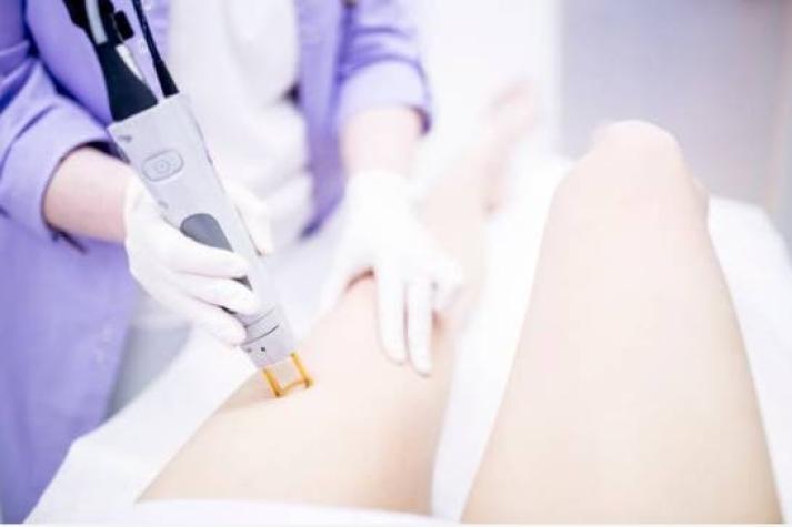 Centro de estética deberá pagar más de $3 millones a mujer por lesiones durante depilación láser