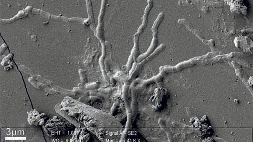 "Asombroso" descubrimiento de neuronas casi intactas en un cerebro en las ruinas de Vesubio
