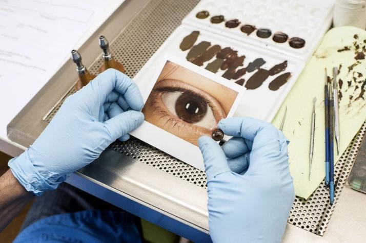 Hechas a mano por odontólogos: El paso a paso para dar una prótesis a víctimas de traumas oculares