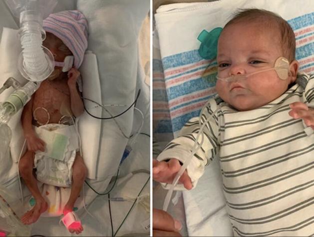 "Bebé milagro" nació prematuro de 22 semanas y tras 133 días internado ya está en su casa