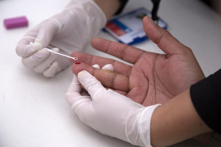 Dia Mundial del VIH/Sida: se realizarán test rápidos de VIH gratuitos en Santiago y Concepción