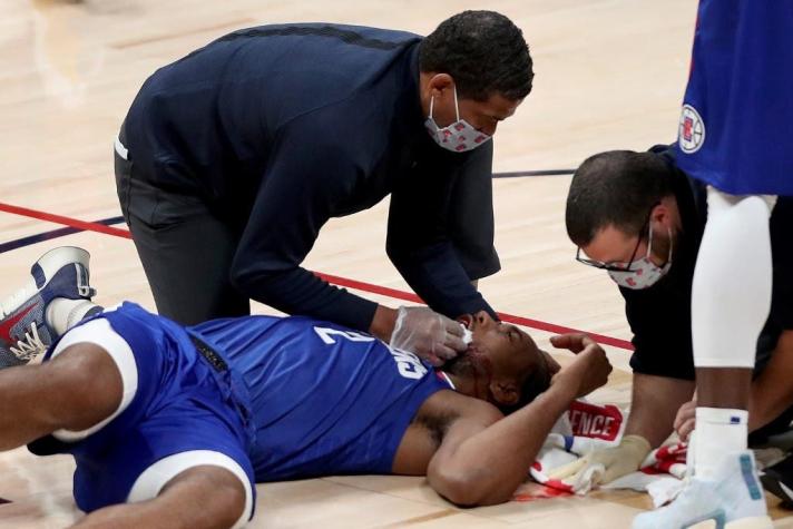 Estrella de la NBA quedó KO tras recibir brutal codazo de un compañero