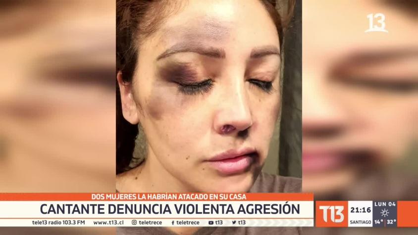 [VIDEO]  "Rancherita" denuncia violenta agresión: 2 mujeres la habrían atacado en su casa