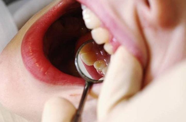 [VIDEO] Extraen un diente atorado en el tímpano de un niño de 3 años