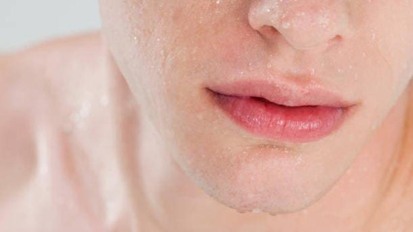 "Parece ardilla": Ejercicios de mandíbula transformaron dramáticamente la cara de un modelo