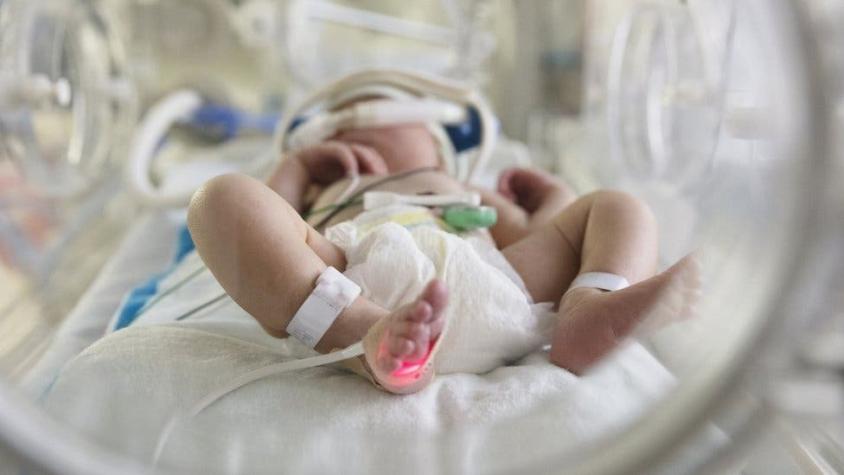 Por qué mueren 10 veces más bebés por covid-19 en Brasil que en Estados Unidos