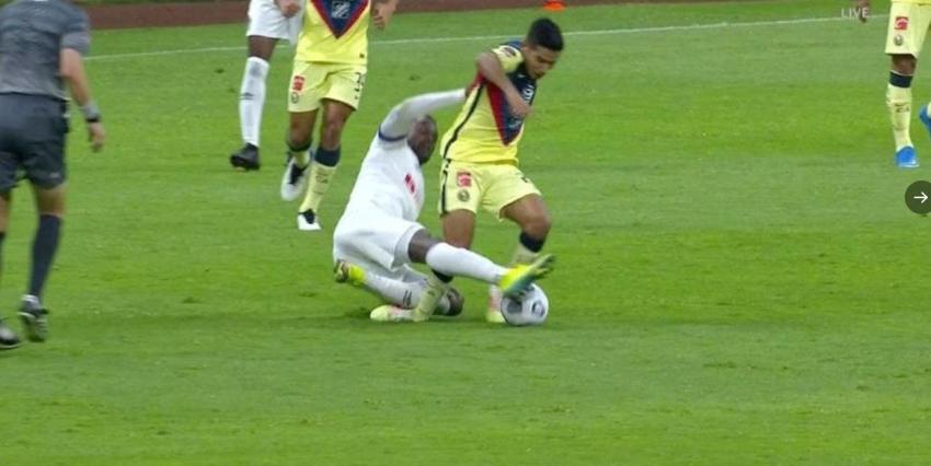 Violento partido de Concachampions termina con escalofriante fractura de jugador del América