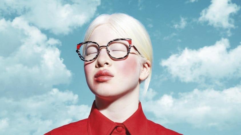 La bebé albina abandonada en China que se convirtió en modelo de Vogue