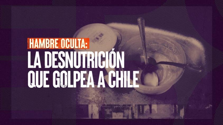 [VIDEO] Reportajes T13: Hambre oculta, la desnutrición vuelve a golpear a Chile