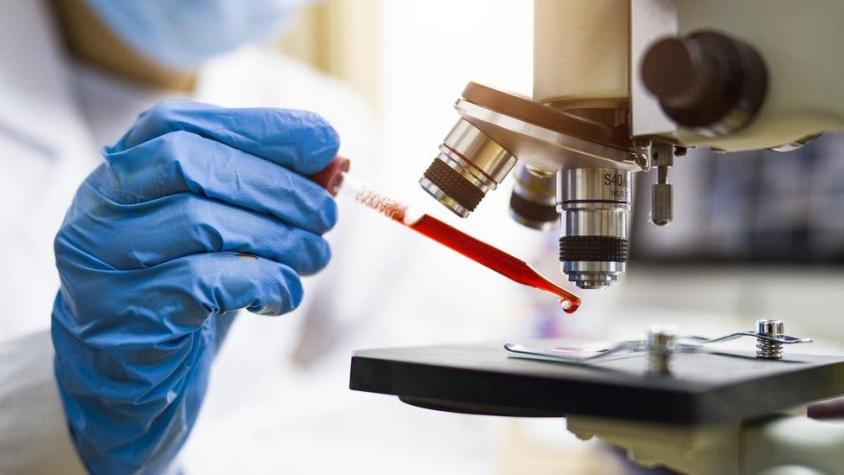 Coronavirus: cómo la tecnología ARNm puede abrir las puertas a una vacuna contra el cáncer Coronavirus: cómo la tecnología ARNm puede abrir las puertas a una vacuna contra el cáncer