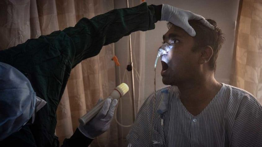 Hongo negro: 5 preguntas clave sobre la infección fúngica que ataca a pacientes de COVID-19 en India