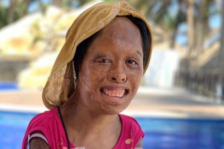 El estremecedor caso de Juanita: niña golpeada y quemada por su padre, quien la vendió a otro hombre