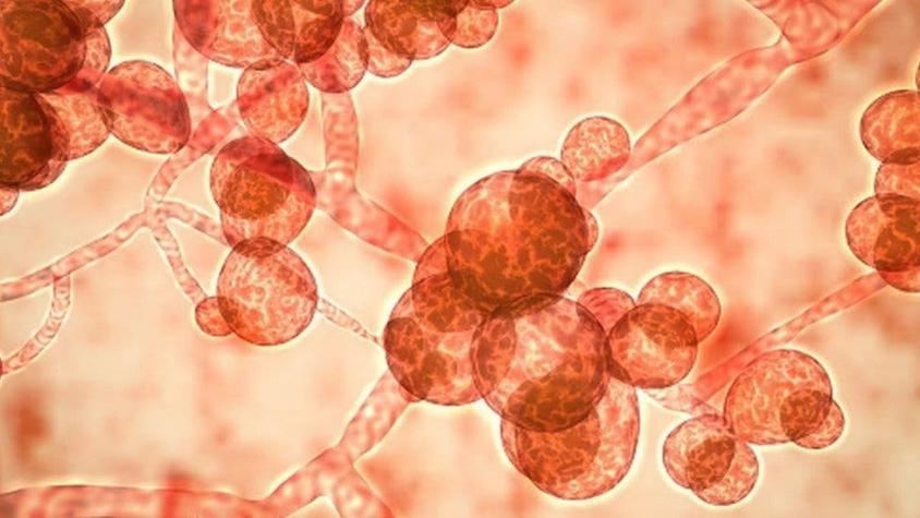 Coronavirus: Candida auris, el otro hongo resistente a los antibióticos que amenaza la recuperación