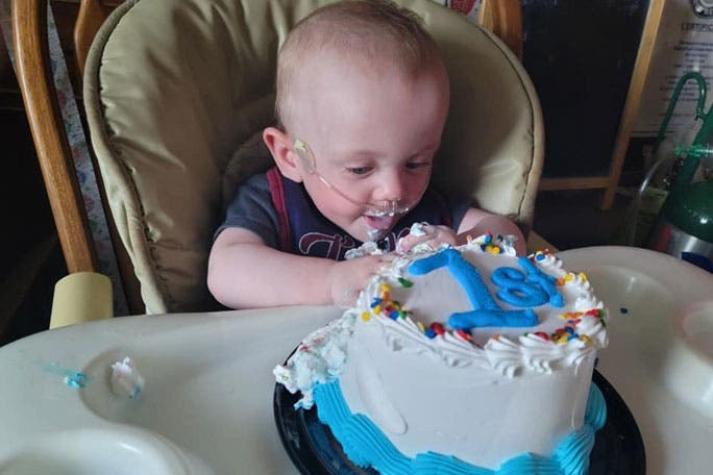 [FOTOS] Bebé más prematuro del mundo y con 0% de sobrevida, festejó su primer cumpleaños
