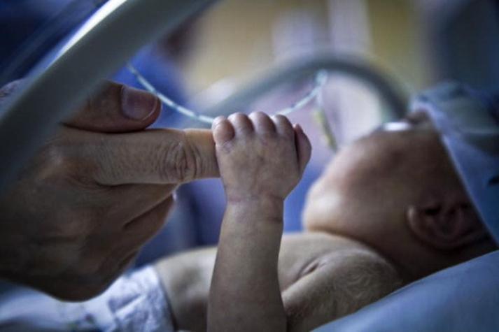 Recibió 13 puntos: bebé recién nacida sufrió corte en su cara durante cesárea de emergencia