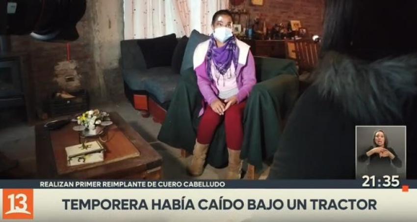 [VIDEO] Realizan primer reimplante de cuerpo cabelludo en Chile