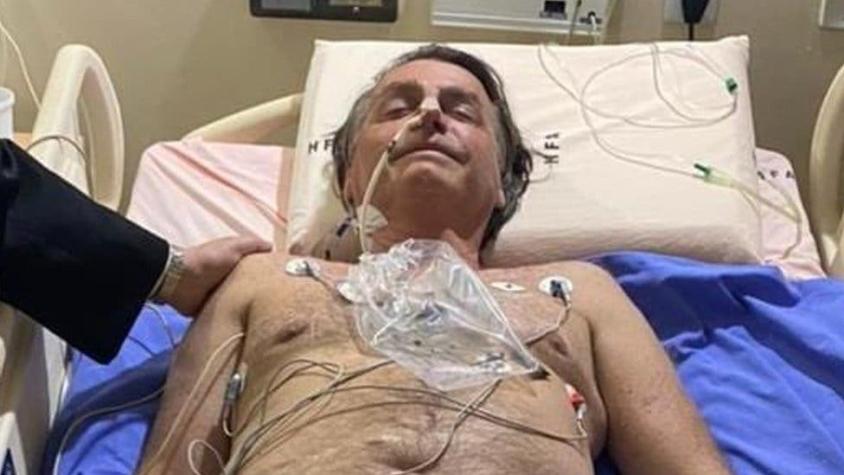 Bolsonaro sale del hospital tras sufrir obstrucción intestinal que le provocó hipo por diez días